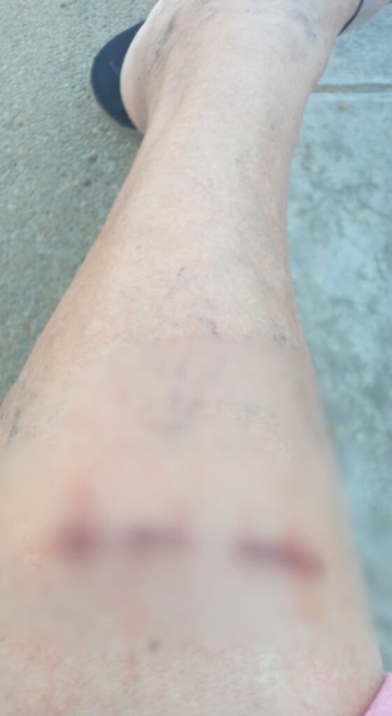 Ataques de cães não param em Serra Talhada; agente de saúde foi alvo