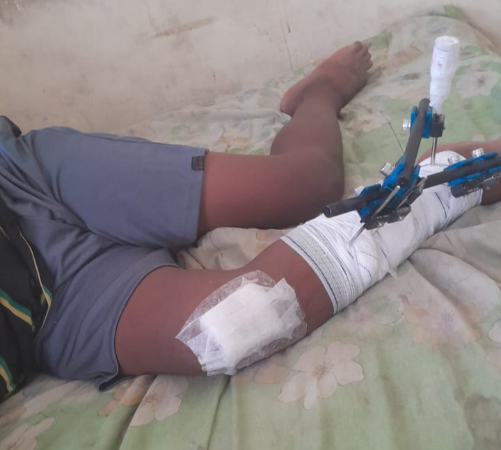 Mãe de criança atropelada na BR-232 inicia campanha em Serra Talhada