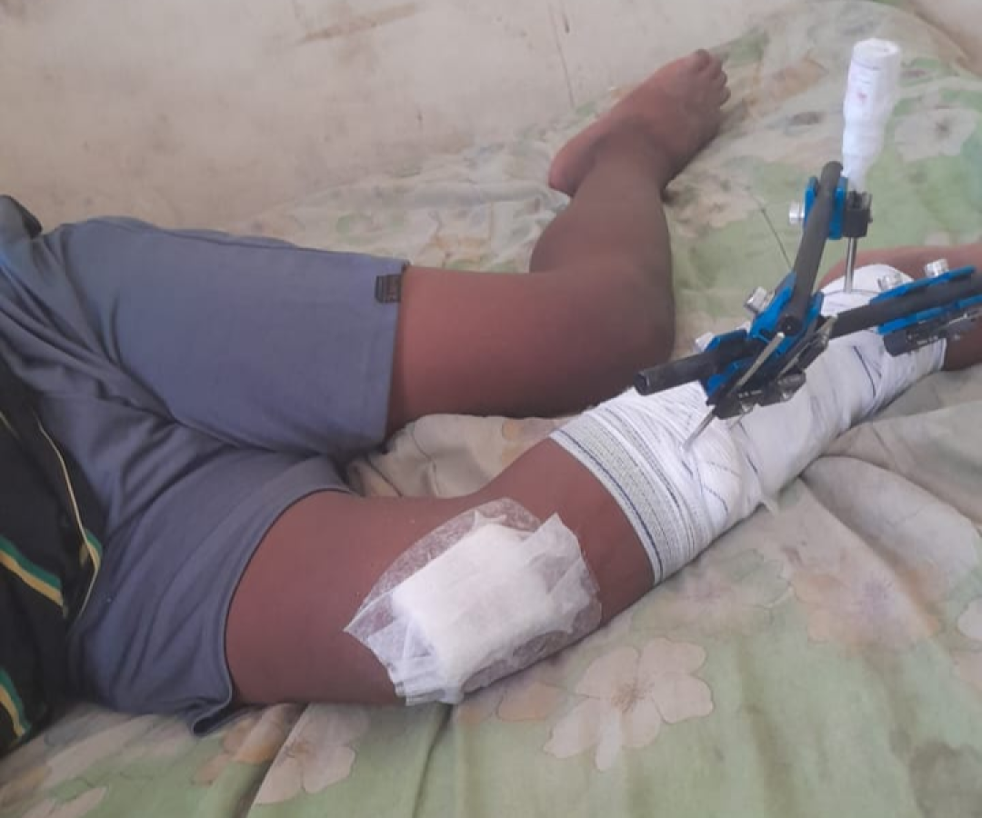 Mãe de criança atropelada na BR-232 inicia campanha em Serra Talhada