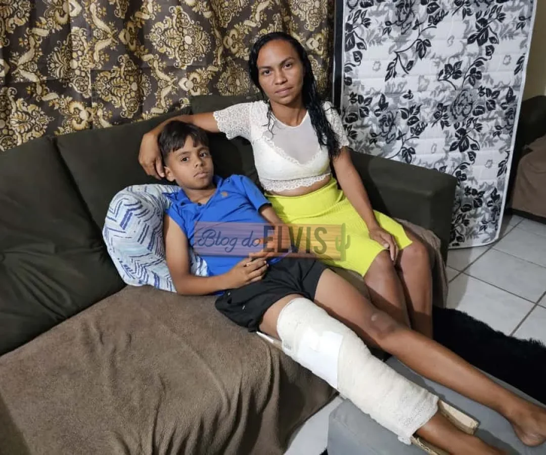 Menino atropelado por caminhão do lixo recebe alta